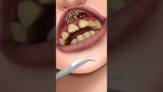ASMR Mouth | Treatment of the mouth and purification from sepsis | ASMR ANIMATION | #shorts #asmr