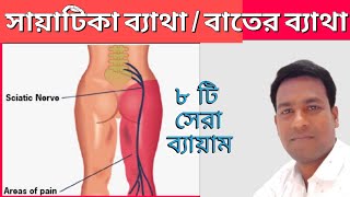 সায়াটিকা ব্যথা নো চিন্তা। সায়াটিকা ব্যথা সারবেই চ্যালেঞ্জ।