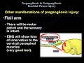 brachial plexus pre and postganglionic injury