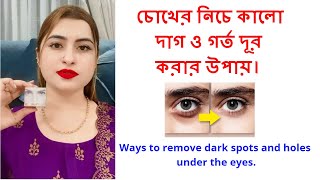 চোখের নিচে কালো দাগ ও গর্ত দূর করার উপায়। Ways to remove dark spots and holes under the eyes. 2023