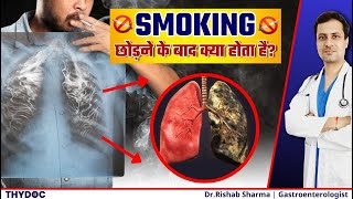 धूम्रपान छोड़ने के बाद क्या होता है? | Smoking Withdrawal Symptoms | Smoking छोड़ने के फ़ायदे