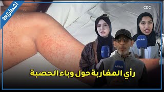 هل نحن في خطر؟.. مغاربة يعبرون عن تخوفهم من انتشار بوحمرون ويطالبون الوزارة بالتدخل