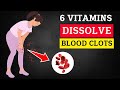 6 Vitamins To DISSOLVE Your BLOOD CLOTS - FITPECIAL