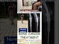 Osteosarcoma- Bone Cancer Knee treated successfully - Dr Rajat Gupta @bonecancerclinic