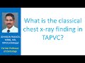 what is the classical chest x ray finding in tapvc