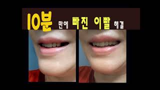 가짜이빨 (fake teeth)10분만에 만들기