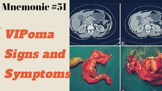 VIPoma signs and Symptoms | Medical Mnemonic #51