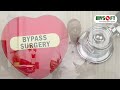 ঈদে হৃদরোগীদের খাবারে সতর্কতা caution in food for heart patients during eid mysoft limited