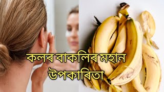 কলৰ বাকলিৰ মহান উপকাৰিতা | Banana Peel benifits| MissMou's Health Tips