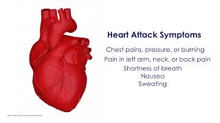 Heart Attack Signs: Do Not Delay Emergency Care