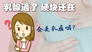 硬块是堵塞？是瘤？还是乳癌？哺乳期照X光了奶还可以要吗？哺乳期患癌怎么办？