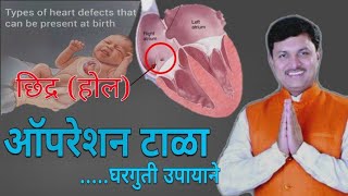 हृदयाचे छिद्र बुजवा ऑपरेशन शिवाय | heart hole | Dr Swagat Todkar tips in Marathi | स्वागत तोडकर