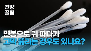 귀 파다 고막 구멍?? 귀에서 부스럭 소리 들린다면 병원가세용