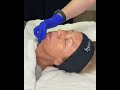 hydrafacial timelapse