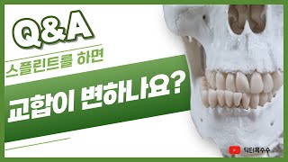 스플린트를 하면 교합이 변하나요?