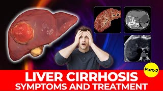 Fatty Liver Symptoms-2 | Early Signs of Fatty Liver Disease | Non Alcoholic Fatty Liver Disease