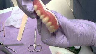 Denture Flange - Check Extension