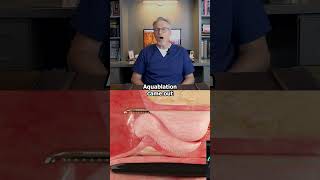 BPH Treatment Options