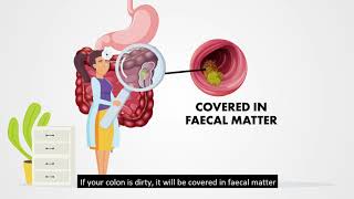Preparing for a Colonoscopy at NUH