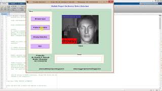 Matlab Code Drowsy Driver Detection