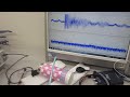 ステンレス容器を利用した超音波発振制御技ーー超音波の非線形制御システムを開発する技術ーー（超音波システム研究所）