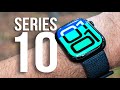 Apple Watch Series 10 Unboxing / First Look (Jet Black!)