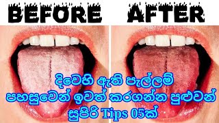 5 Tips for removing Tongue Mark at home | දිවෙහි ඇති පැල්ලම් ඉවත් කරගන්න පුළුවන් සුපිරි Tips 05ක්