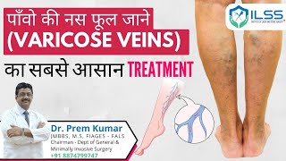 पाँवो की नस फूल जाने (Varicose Veins) का सबसे आसान Treatment | Dr Prem Kumar | #VaricoseVeins