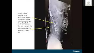 MICQNW 2021 McLaren Northern Michigan - Radiology