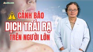 Cảnh báo dịch trái rạ trên người lớn | BS Trương Hữu Khanh