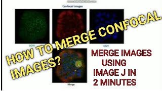 How to merge two or more images using Image J? II Xgene and proteinX