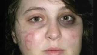 Ashley Todd "Mutilation" Scam Exposed