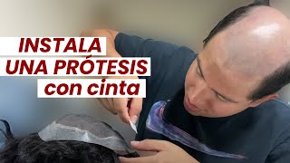 Paso a paso para instalar una prótesis capilar con cinta!