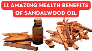 11 Amazing Health Benefits of Sandalwood Oil