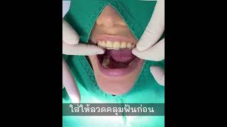 How to wear retainer l วิธีใส่รีเทนเนอร์ท่อสี l หมอตาล คุยจัดฟัน