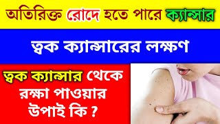 ত্বক ক্যান্সারের প্রবণতা গ্রীষ্মের প্রচণ্ড তাপদাহে | ত্বক ক্যান্সারের লক্ষন | Skin Cancer