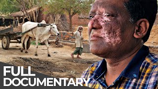 Extreme India: Cow Vigilantes, Disabled Dating & More | Unreported World | Free Documentary