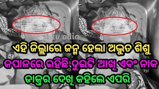 ଓଡ଼ିଶାରେ ଜନ୍ମ ହେଲା ଏକ ଅଦ୍ଭୁତ ଶିଶୁ, କପାଳରେ ରହିଛି ଦୁଇଟି ଆଖି ଏବଂ ନାକ by sl tv odia