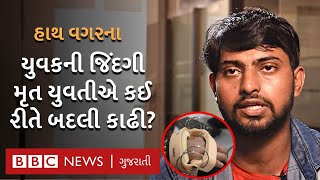 Hand Transplant : હાથ કપાઈ ગયો તો સર્જરી કરાવી બીજાનો હાથ લગાવ્યો અને બદલાઈ ગઈ જિંદગી