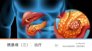 胰腺癌（三）：胰腺癌的治疗选择。最新的胰腺癌的治疗临床研究