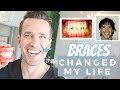 How Braces Changed My Life | Orthodontics | Dr. Nate