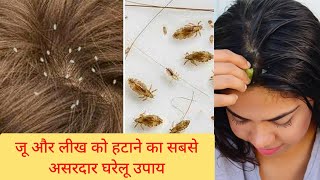 जू और लीख से छुटकारा पाने का घरेलू नुस्खा Lice and Nits Removal Home Remedy दोबारा कभी जू नहीं होगी