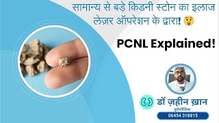 सामान्य से बड़े किडनी स्टोन का इलाज लेज़र ऑपरेशन के द्वारा 😲 PCNL Explained! Dr. Zaheen Khan/Urologist