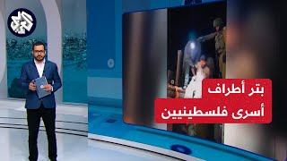 بعضهم بترت أقدامهم.. شهادات أطباء إسرائيليين حول أوضاع الأسرى الفلسطينيين في السجون