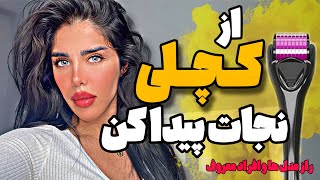 با این دستگاه با ریزش مو خدافظی کن/ آشنایی با درمارولر / خداحافظی با کچلی سلام به پرمویی💖💖