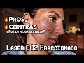 I had the fractional CO2 laser done | Process and Results - Costs and Treatments