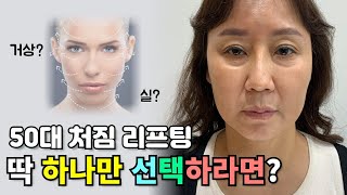 50s MINI FACELIFT REVIEW | Smooth Face Shape, Jawline | Laugh lines, Saggy face, jowls, cheeks