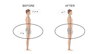 POSTURE®- el a hanyagtartás ellen/ 3