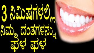 Natural Ways to Whiten Teeth at Home | 3 ನಿಮಿಷಗಳಲ್ಲಿ ನಿಮ್ಮ ದಂತಗಳನ್ನು ಫಳ ಫಳ  | YOYO TV Kannada Health