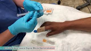 Digital Block - How to Minimize Pain during the Procedure - Henry Hu, MD